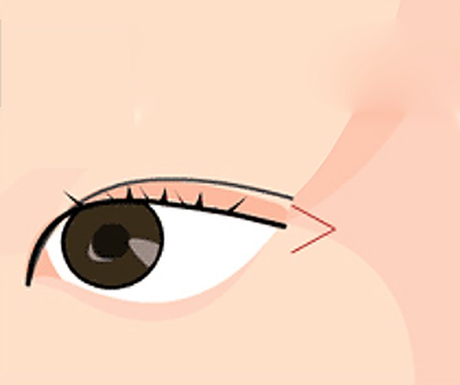뒤트임 — 눈꼬리 바깥쪽을 트는 그림