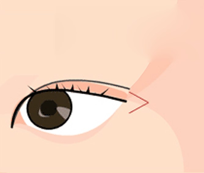 뒤트임 — 눈꼬리 바깥쪽을 트는 그림